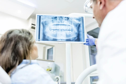 Digital x-rays at Wellness Family Dentistry in Royal Oak, MI.